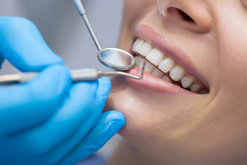 Dental Care Services